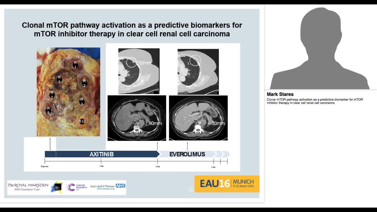 Clonal mTOR pathway activation as a predictive biomarker -