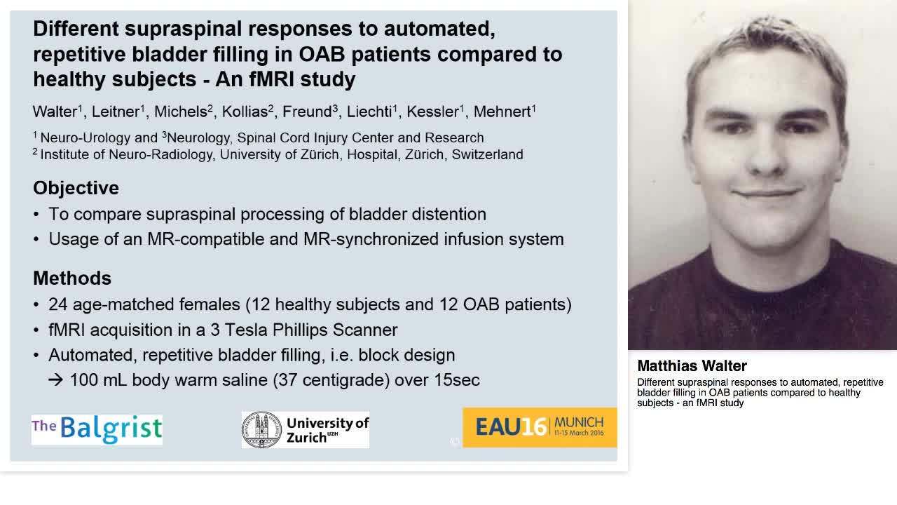 Different supraspinal responses to automated, repetitive -