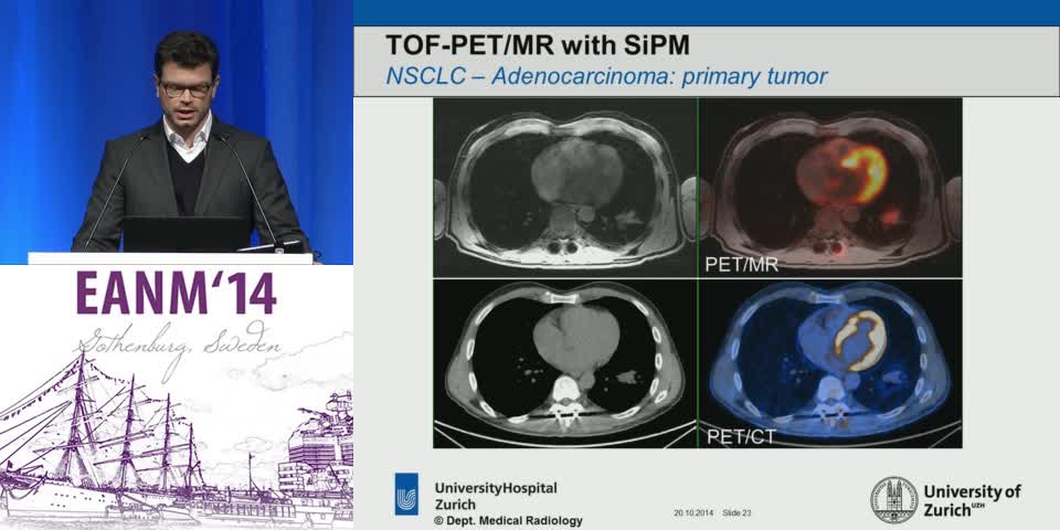 MRI和PET MRI的附加值
