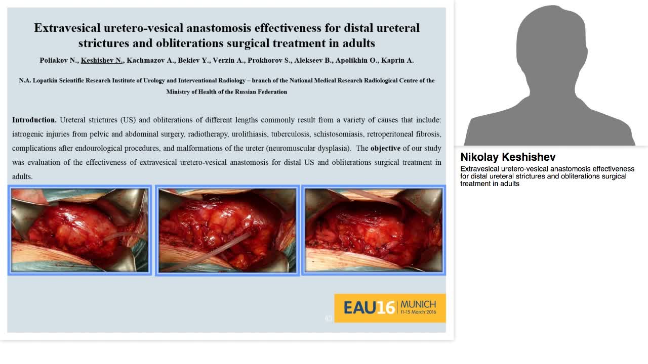 Extravesical uretero-vesical anastomosis effectiveness fo-