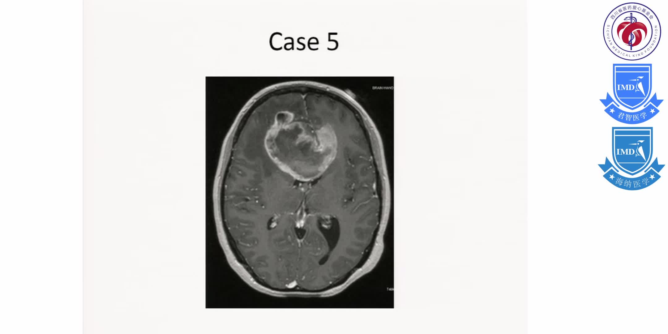 Initial Treatment, Including Scenarios Requiring Urgent and Multi-disciplinary Management for Primary Brain Tumors 6