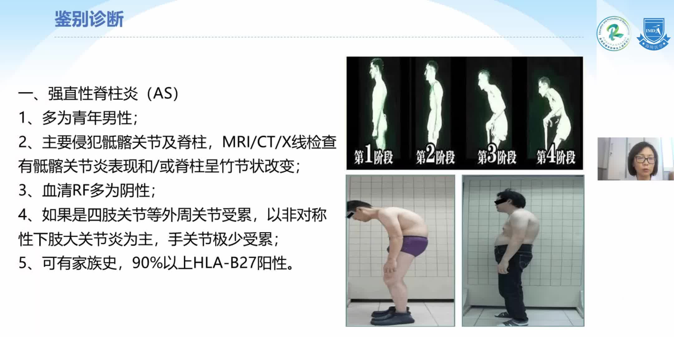 杨静-类风湿关节炎的临床诊治思路（2）