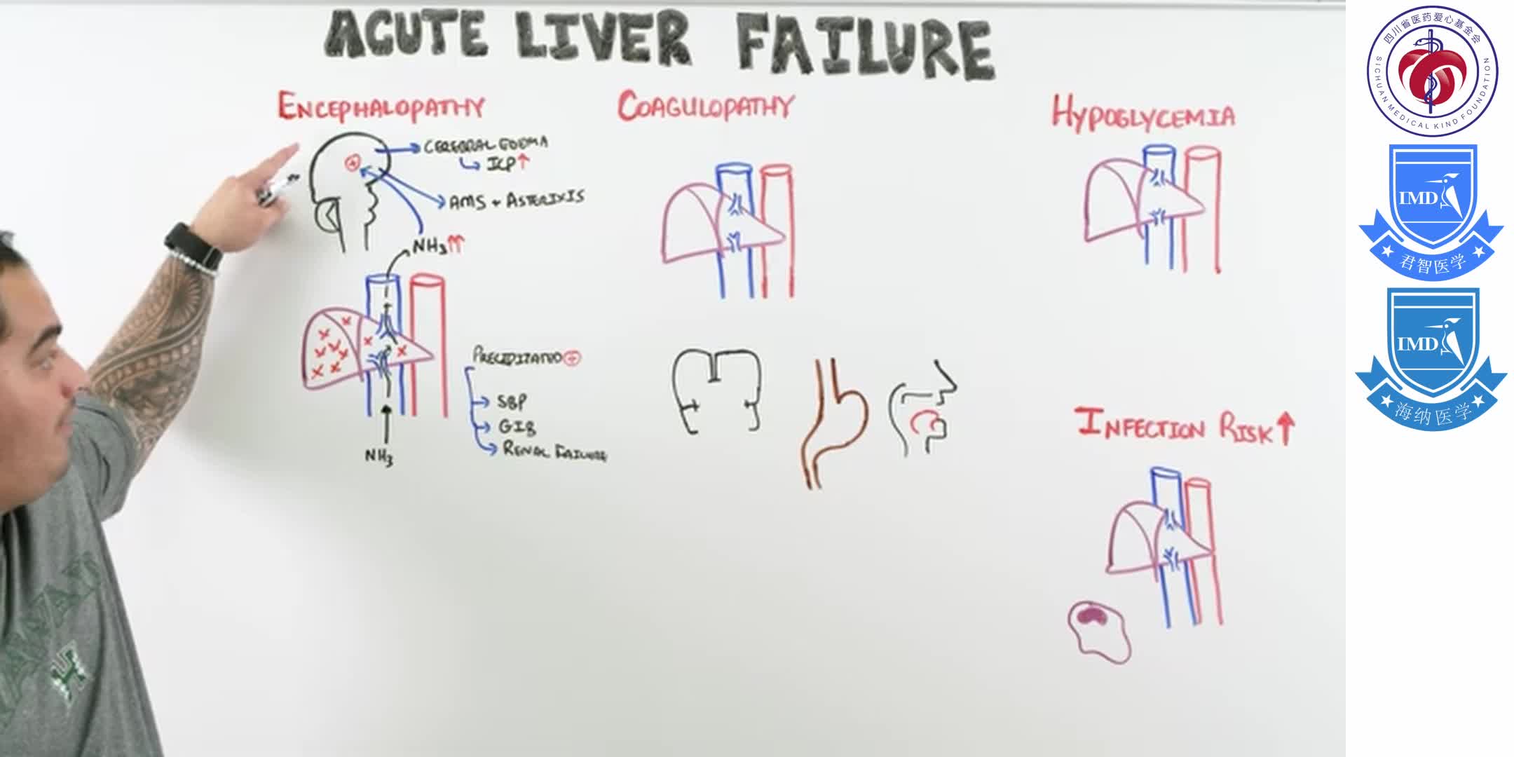 Acute Liver Failure 1-5