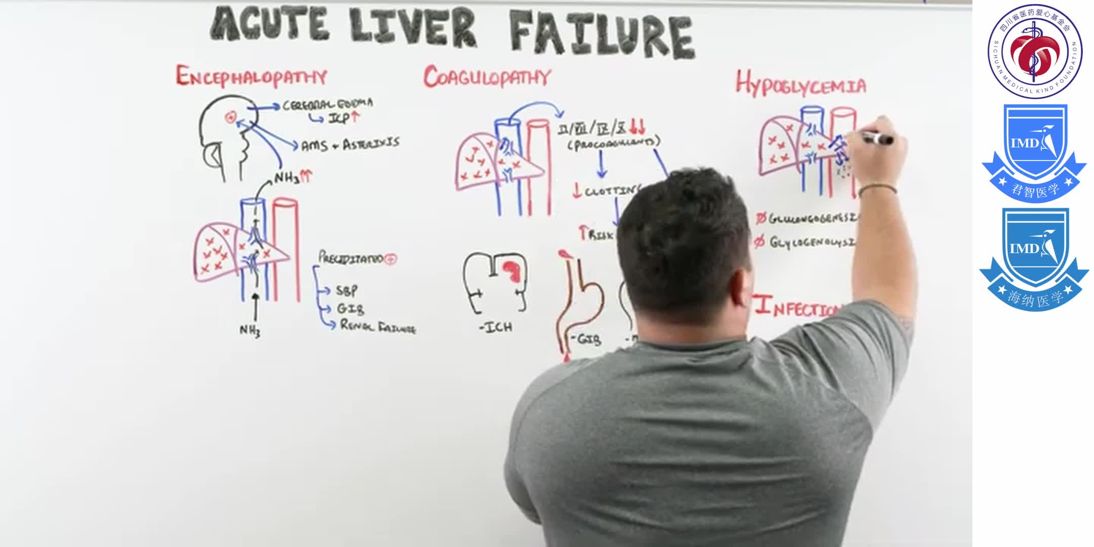 Acute Liver Failure 1-6