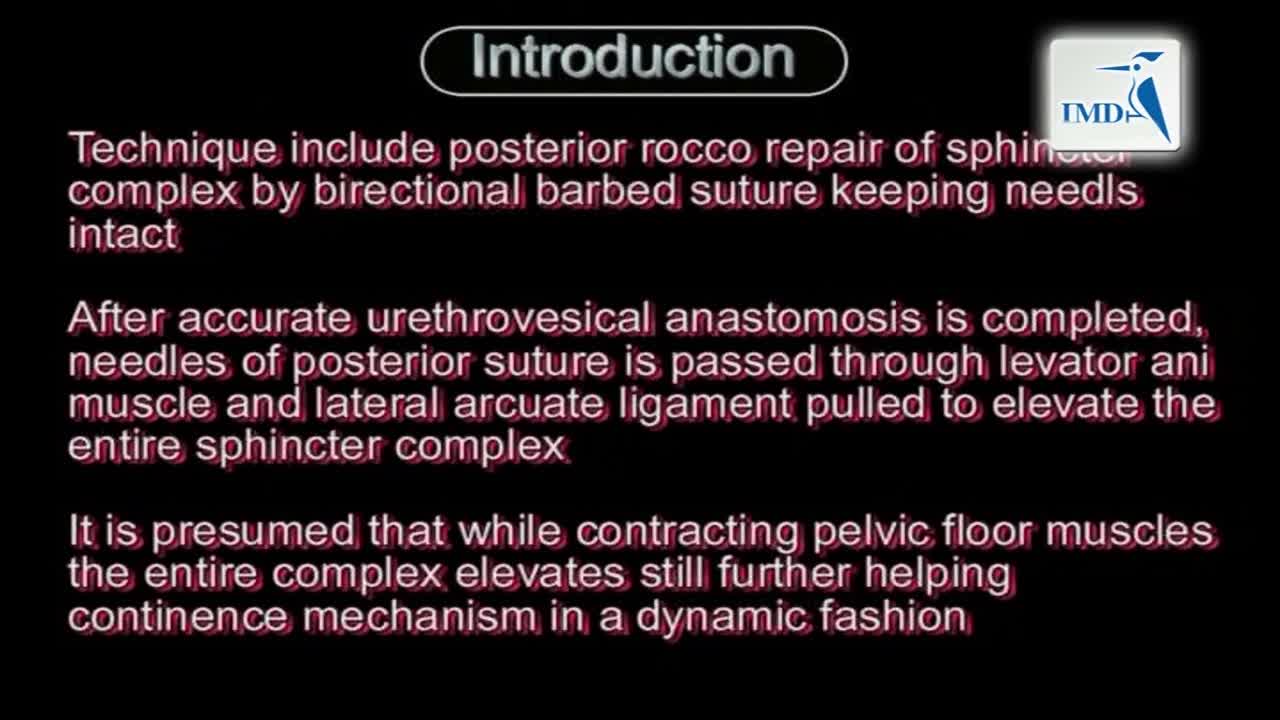 动态侧向悬吊技术DLSPRS可改善早期尿失禁