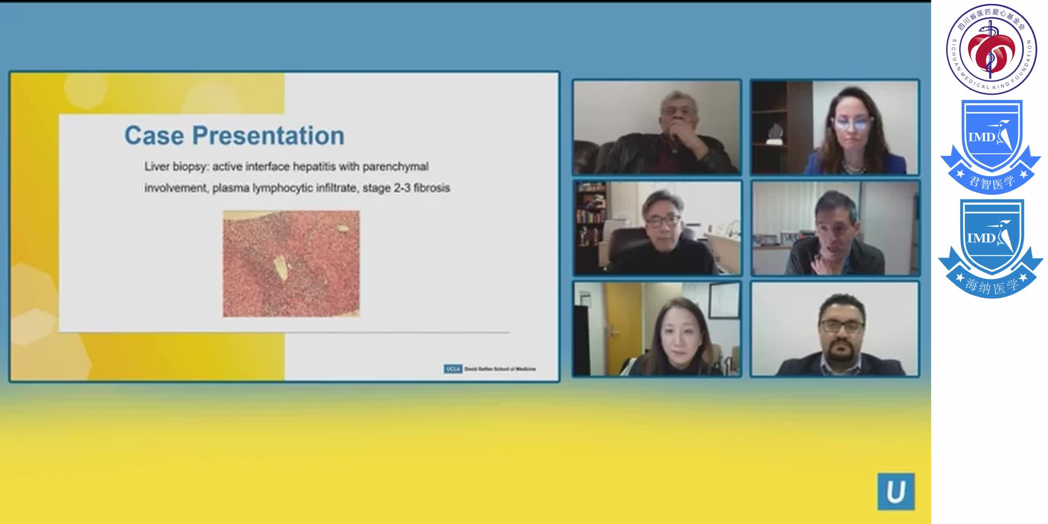 Autoimmune Hepatitis _ Gina Choi, MD _ UCLA Digestive Diseases  1-2