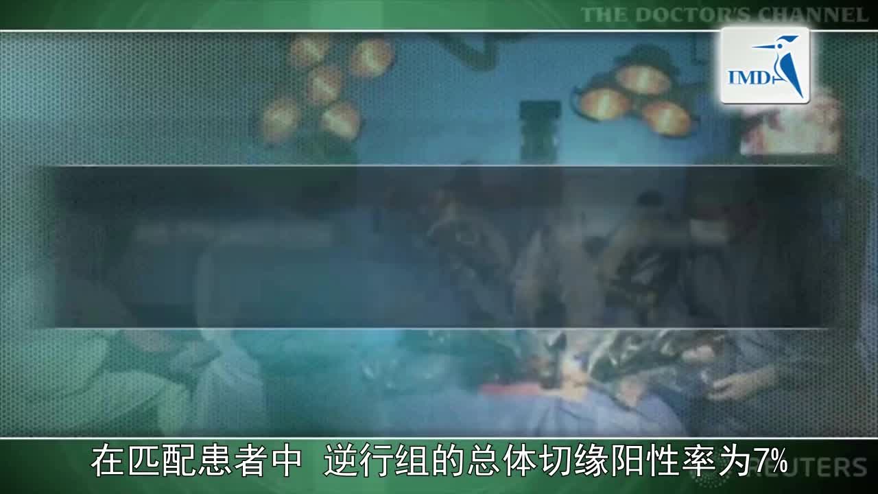 前列腺切除术中逆行神经保留方式可提高性功能的恢复