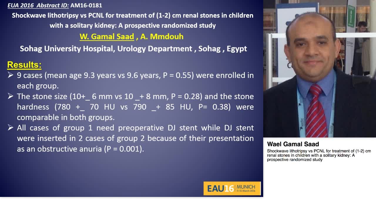 Shockwave lithotripsy vs PCNL for treatment of (1-2) cm r-
