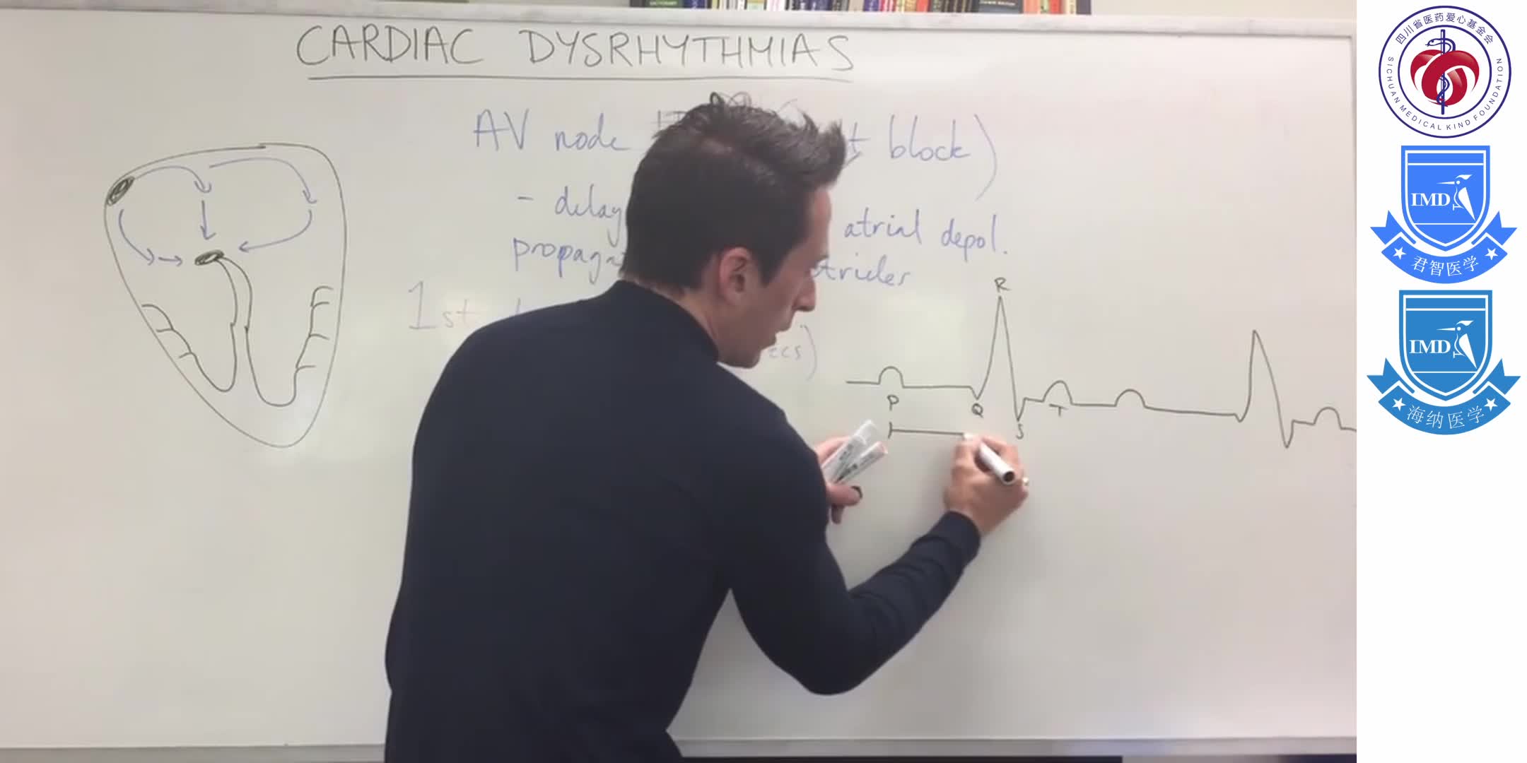 Cardiac dysrhythmias (arrhythmias) 7