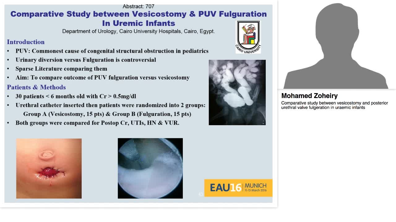 Comparative study between vesicostomy and posterior ureth-