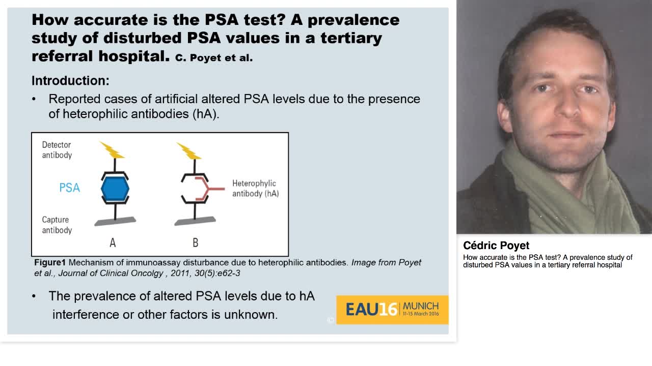 How accurate is the PSA test. A prevalence study of distu-