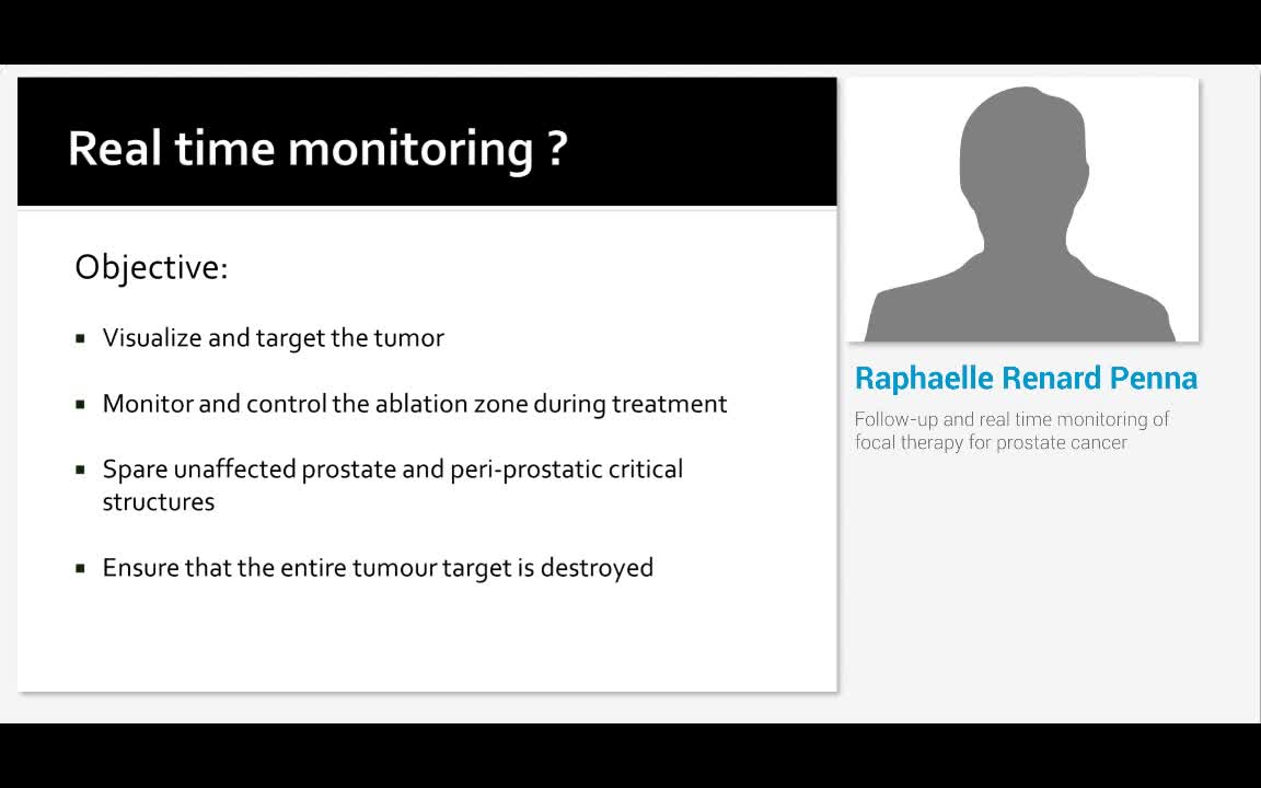Follow-up and real time monitoring of focal therapy for p..-