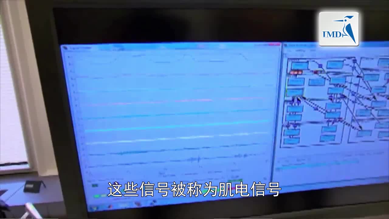 新型控制系统可提升假肢性能