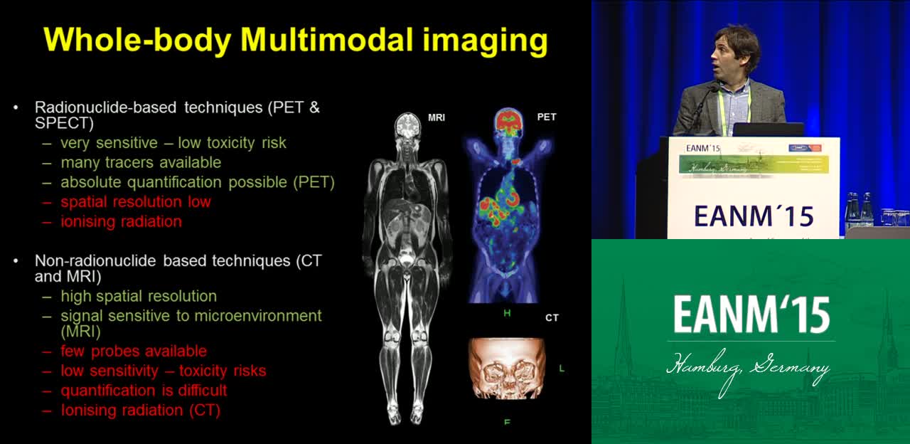 多模式成像探针在乳腺癌黑色素瘤前哨淋巴结成像中的应用