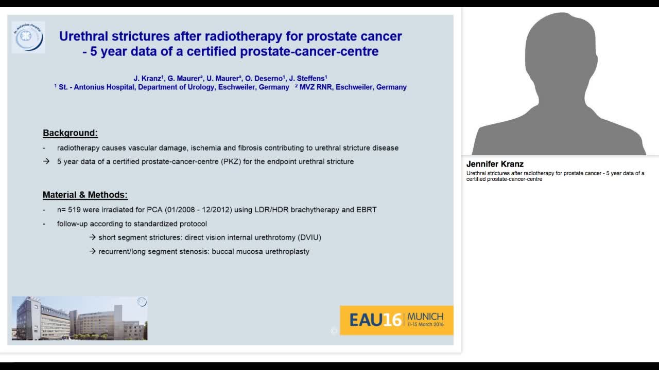 Urethral strictures after radiotherapy for prostate cance-