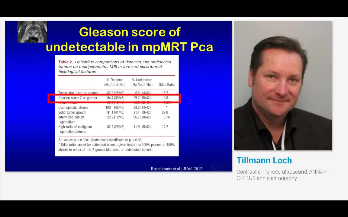 Contrast enhanced ultrasound, ANNA - C-TRUS and elastography