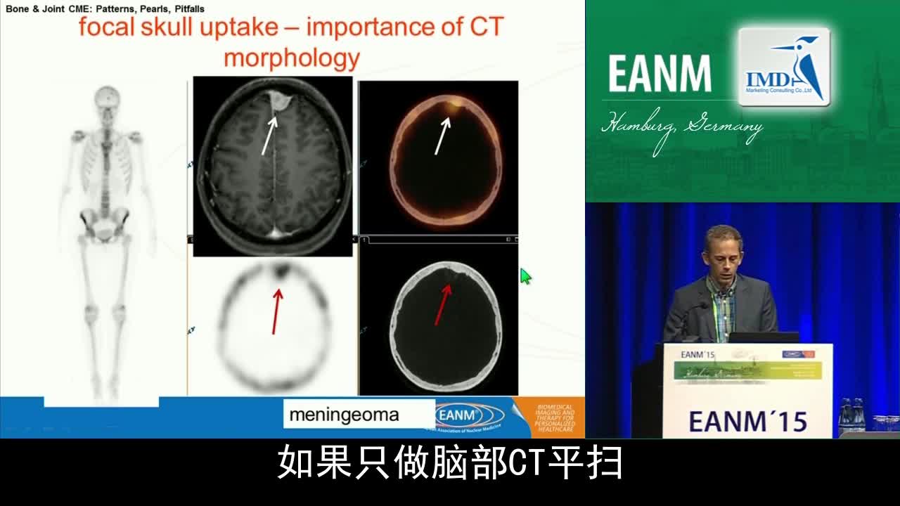骨骼与关节继续医学教育-误区（2）