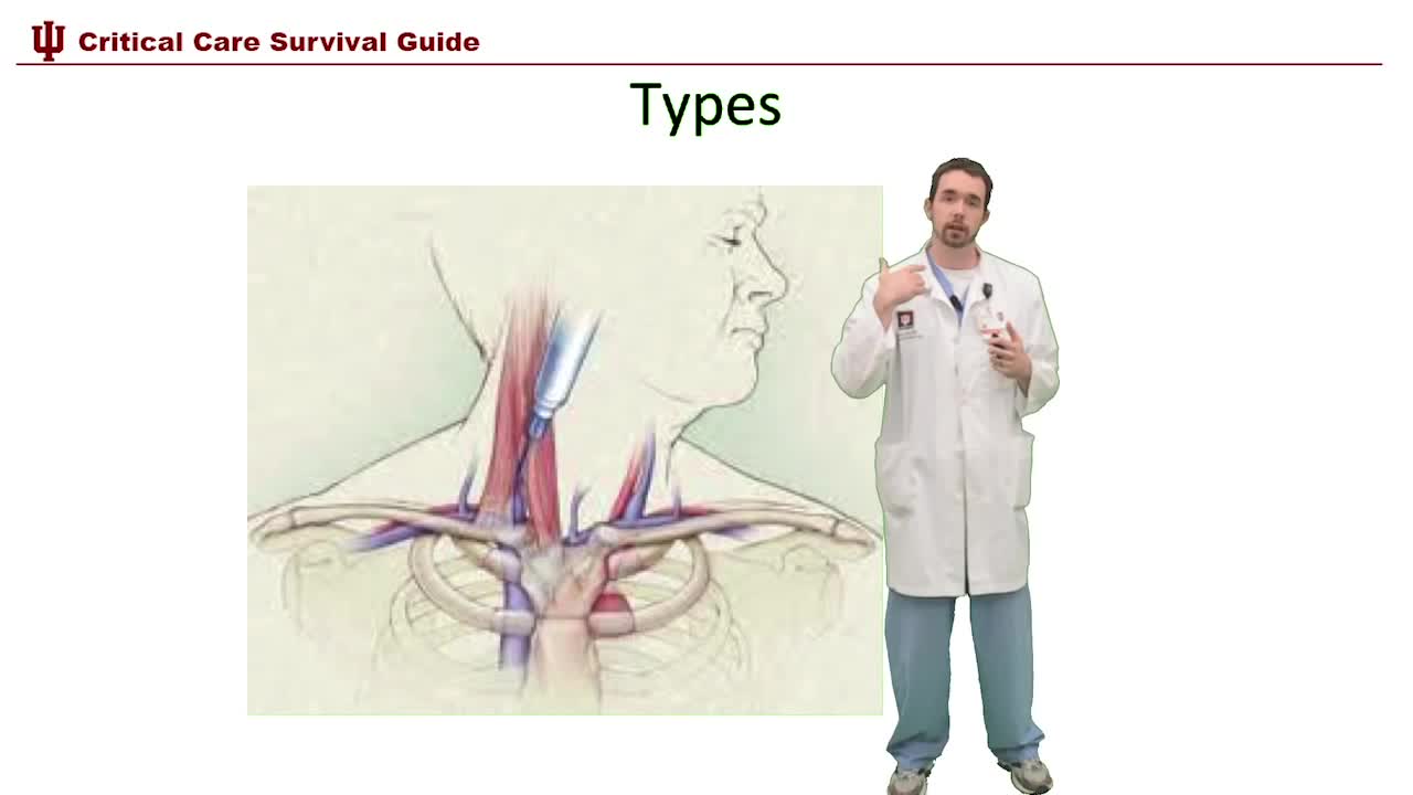 Central lines in ICU