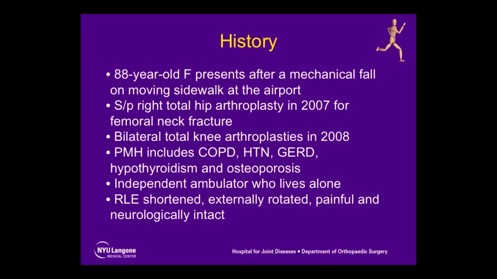 Periprosthetic FemoralShaft Fracture after Total Knee Arthroplasty