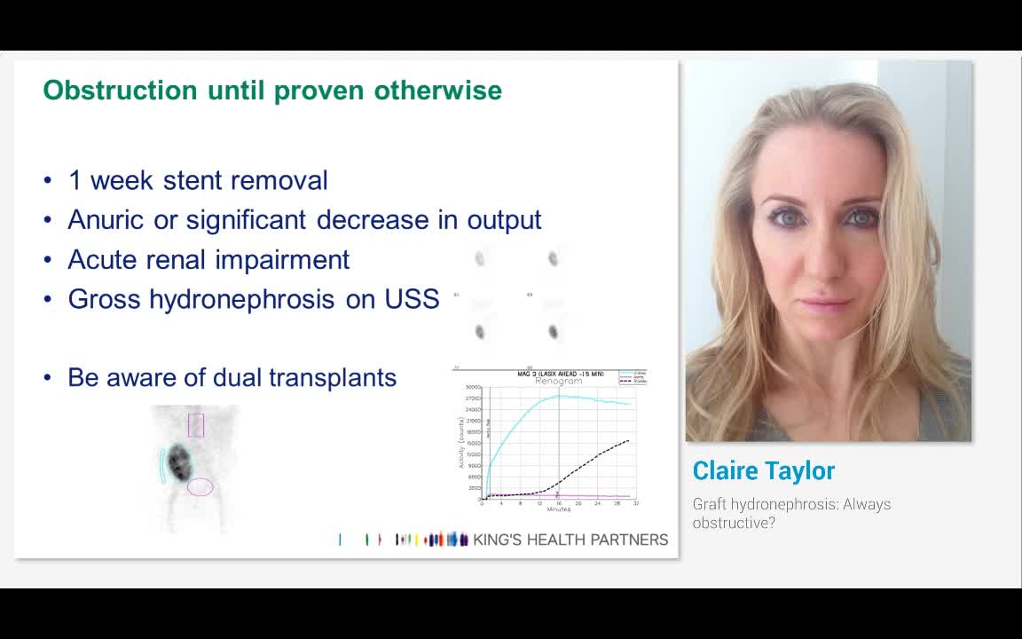移植肾积水，时常梗阻