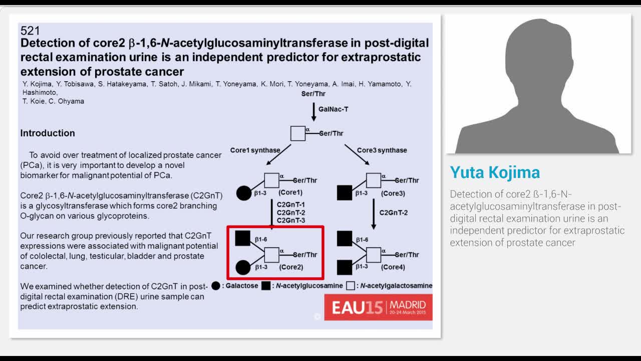 Detection of core2 -1,6-N-acetylglucosaminyltransferase ..-