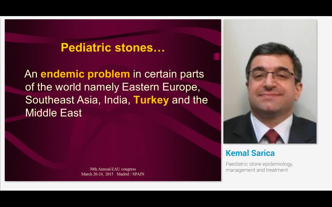 Paediatric stone epidemiology, management and treatment