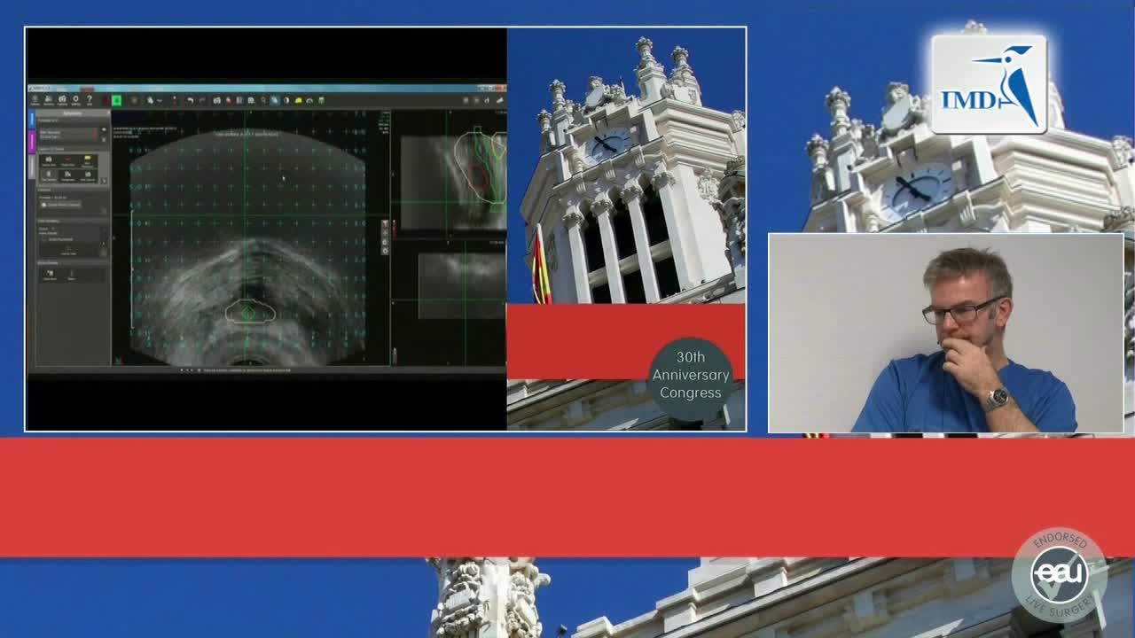 经直肠B超引导前列腺活检术（2）