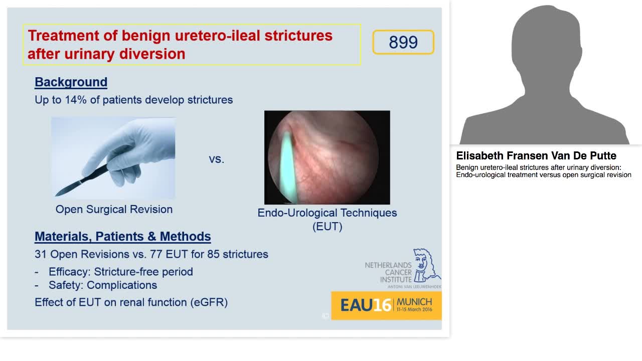 Benign uretero-ileal strictures after urinary diversion, -