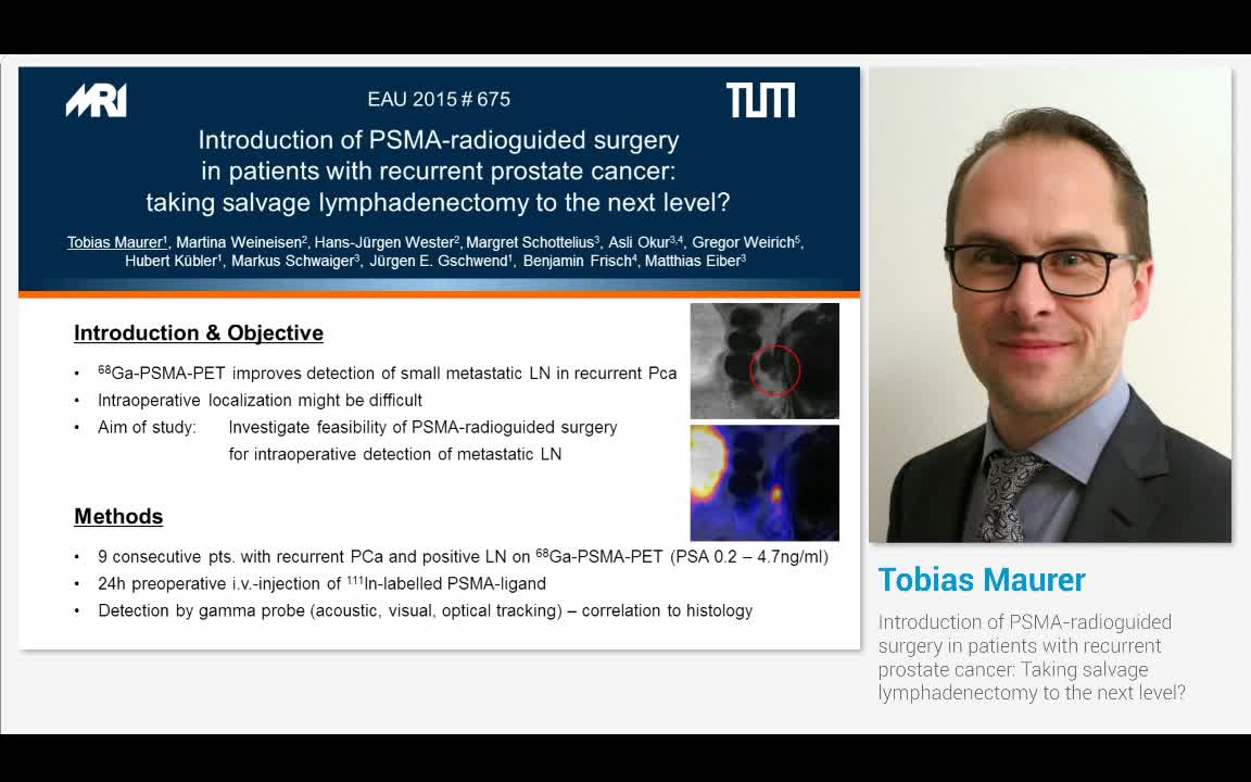 Introduction of PSMA-radioguided surgery in patients with..-