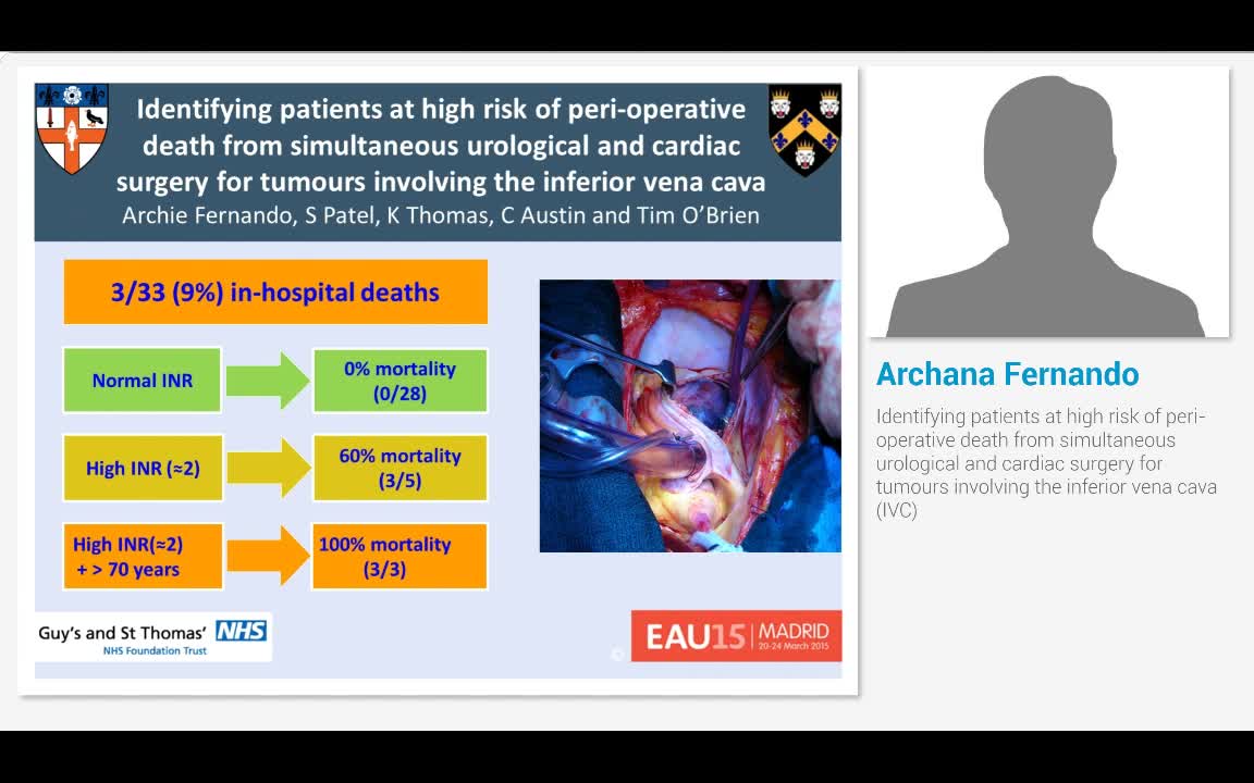 Identifying patients at high risk of peri-operative death..-