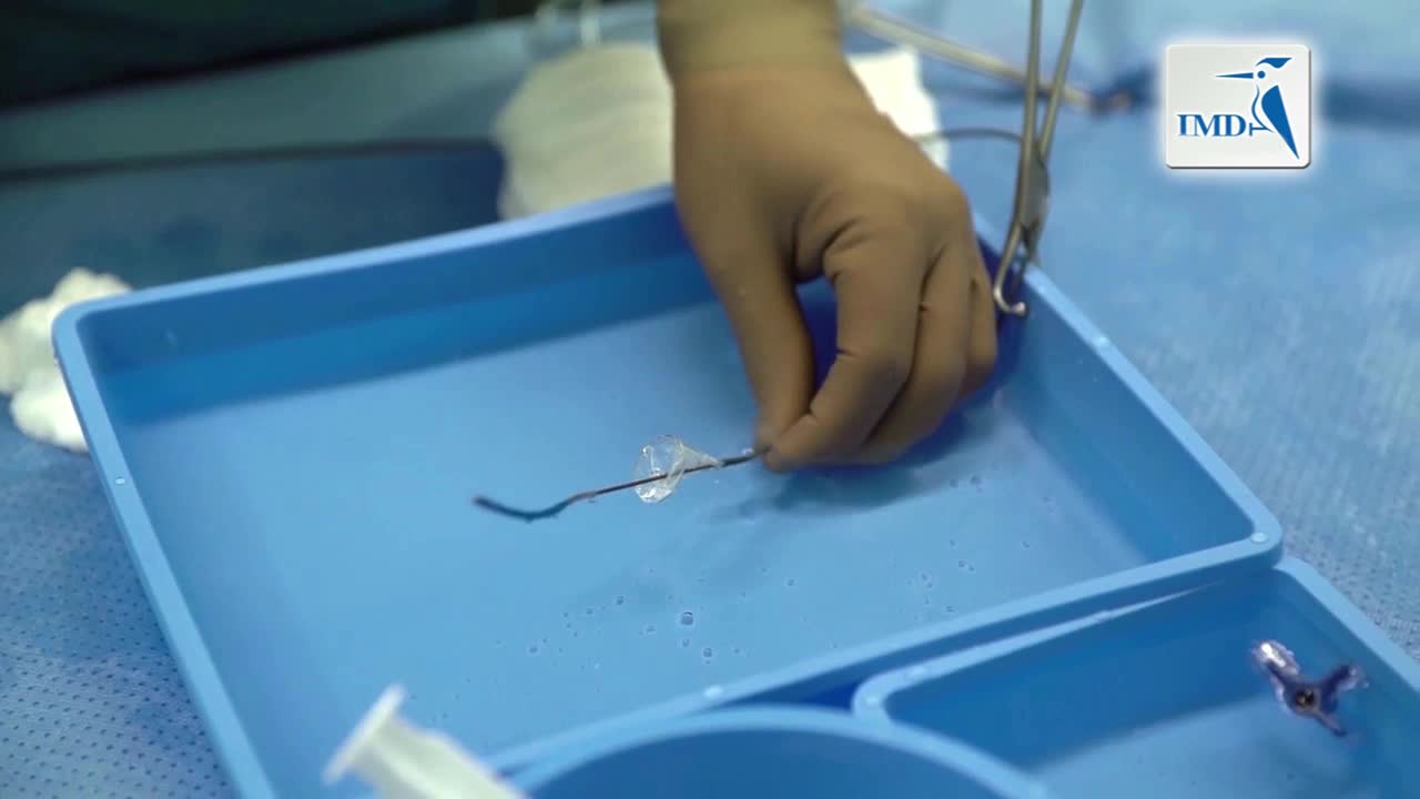 降低心脏瓣膜置换术后脑损伤风险