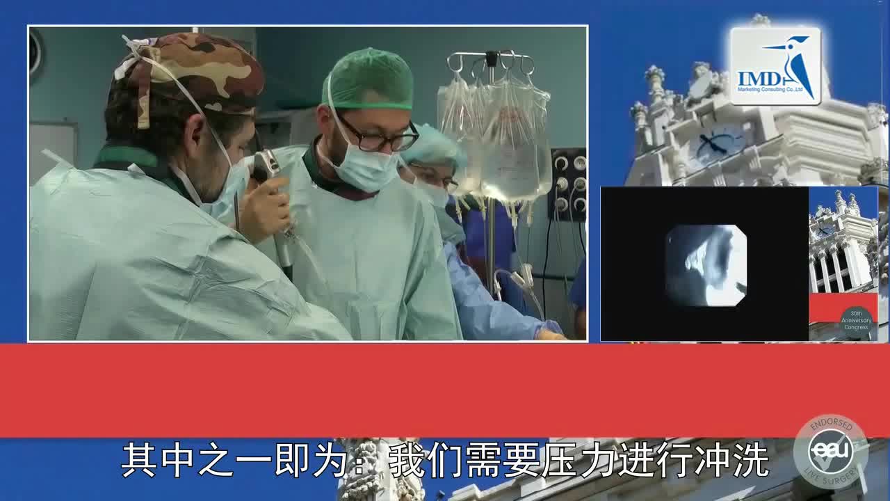 SPIES辅助逆向输尿管软镜诊断治疗上尿路结石（2）