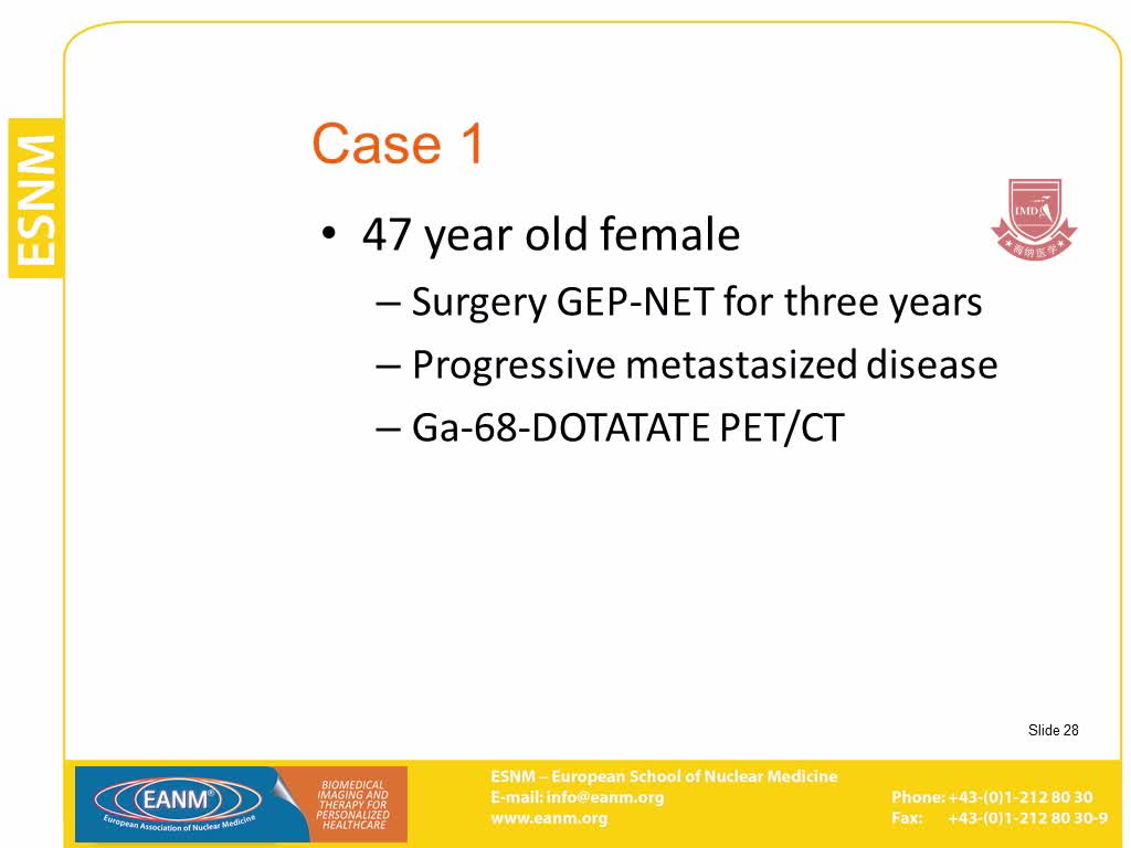 PET CT用于计划和监测放射性核素治疗方案5