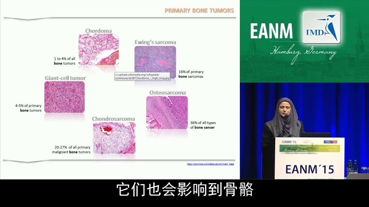骨肉瘤中的分子影像：PET、CT的应用推行