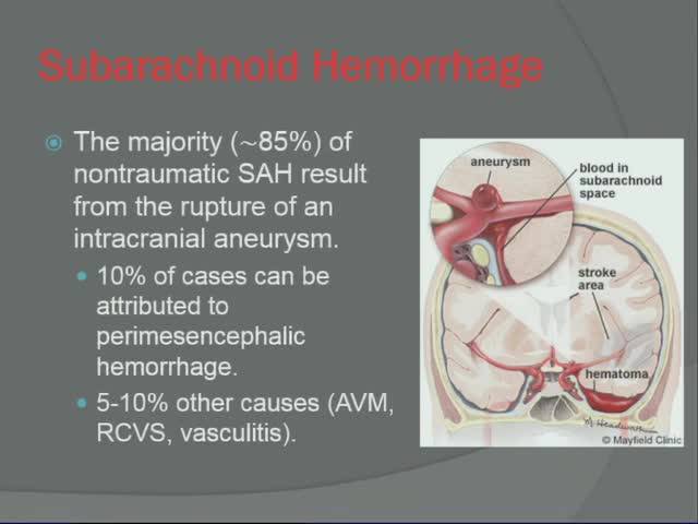 Diagnosis and Management of Aneurysmal Subarachnoid Hemorrhage
