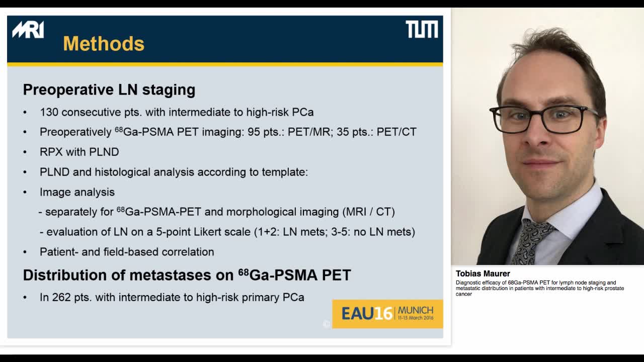 Diagnostic efficacy of 68Ga-PSMA PET for lymph node stagi-