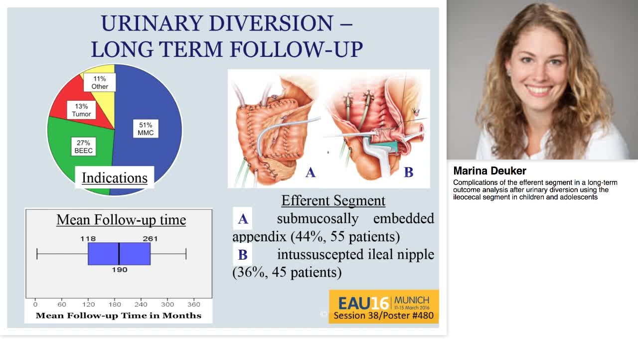 Complications of the efferent segment in a long-term outc-