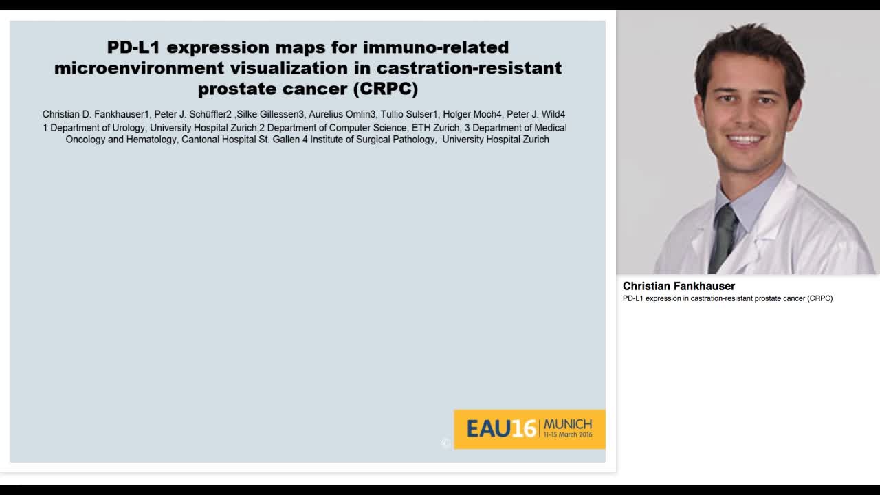 PD-L1 expression in castration-resistant prostate cancer -