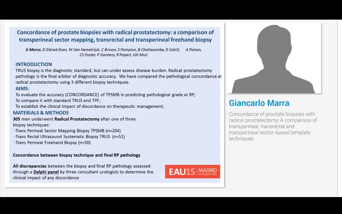 Concordance of prostate biopsies with radical prostatecto..-