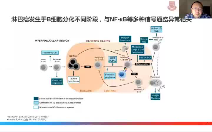 李志铭-来拿度胺在B细胞淋巴瘤中的治疗和进展
