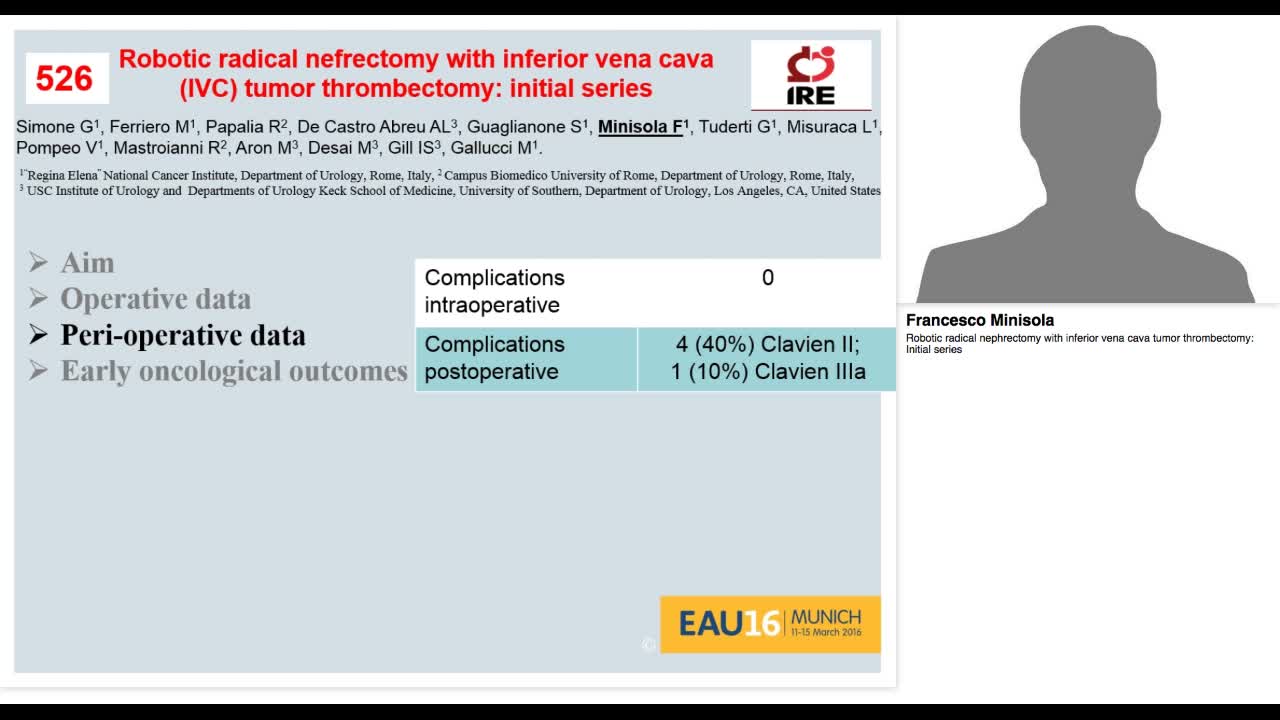 Robotic radical nephrectomy with inferior vena cava tumor-