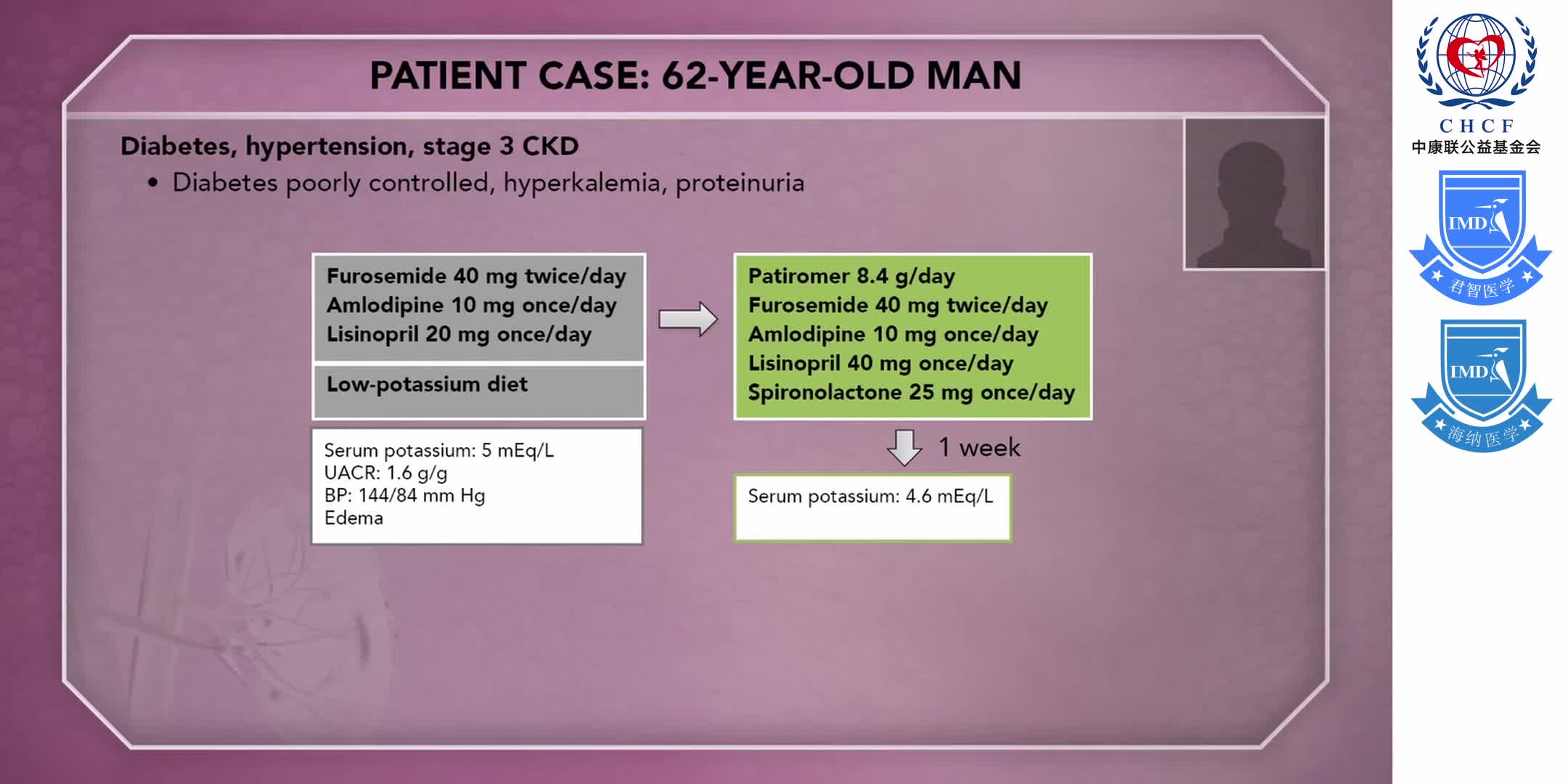 Hyperkalemia in Patients with Chronic Kidney Disease, Including Diabetes 1-5