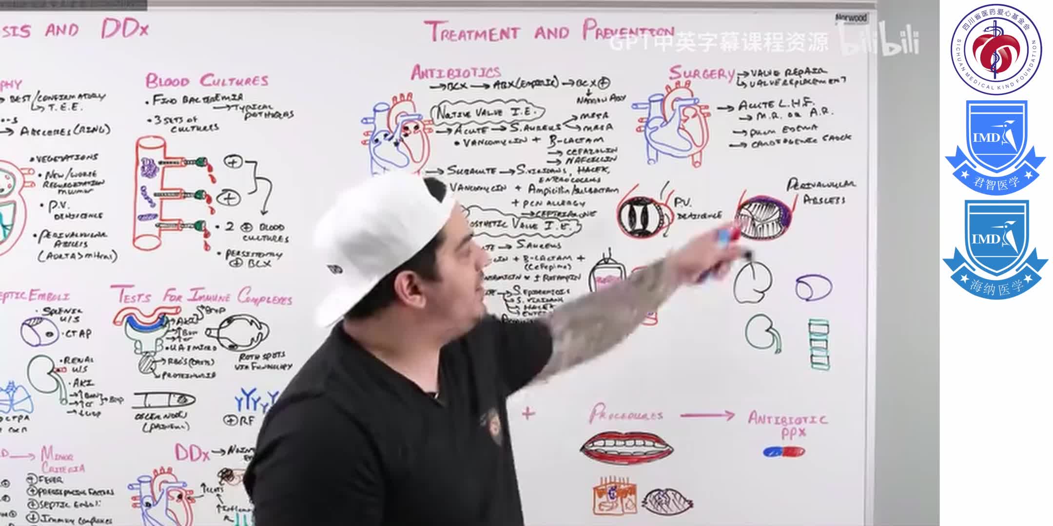 Infective Endocarditis 12