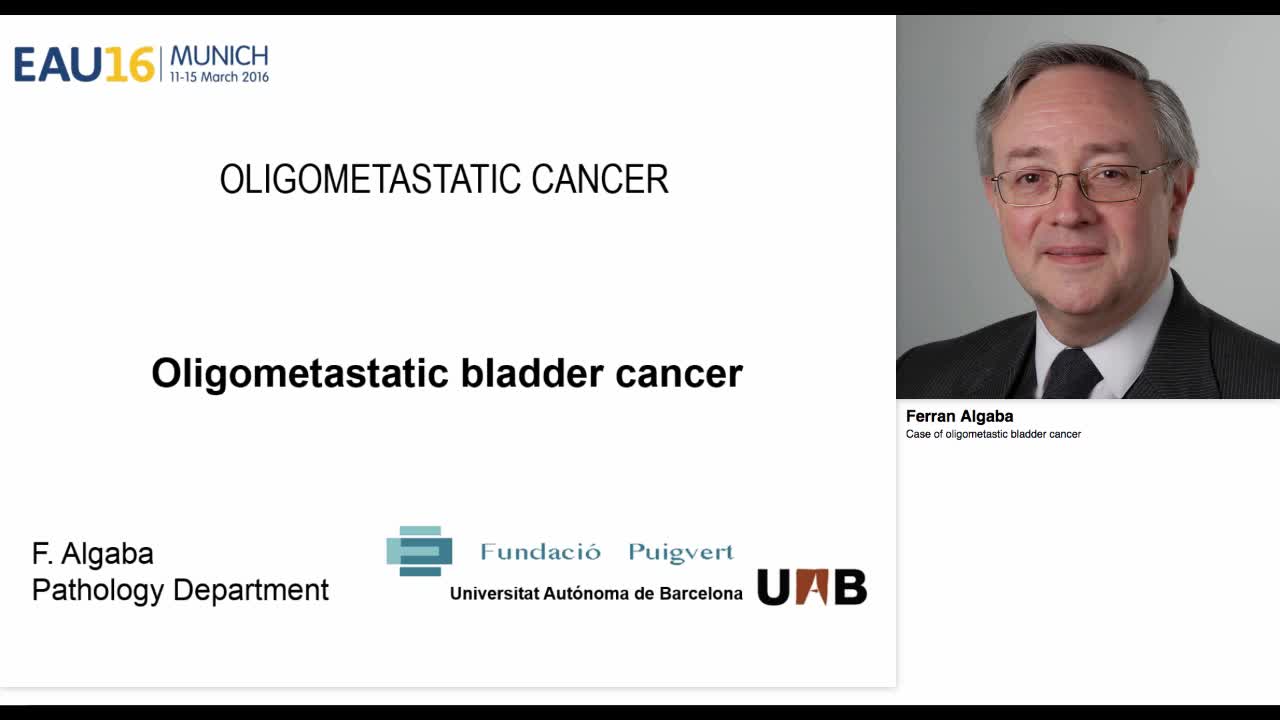 Case of oligometastic bladder cancer