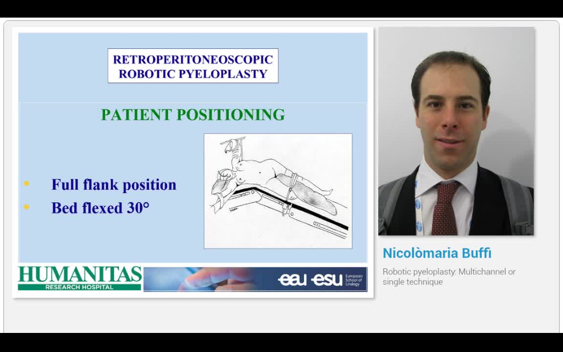Robotic pyeloplasty, Multichannel or single technique
