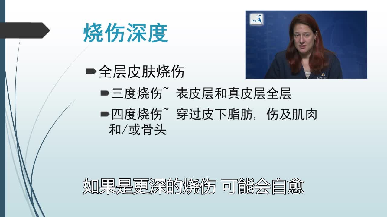 急性烧伤管理（2）