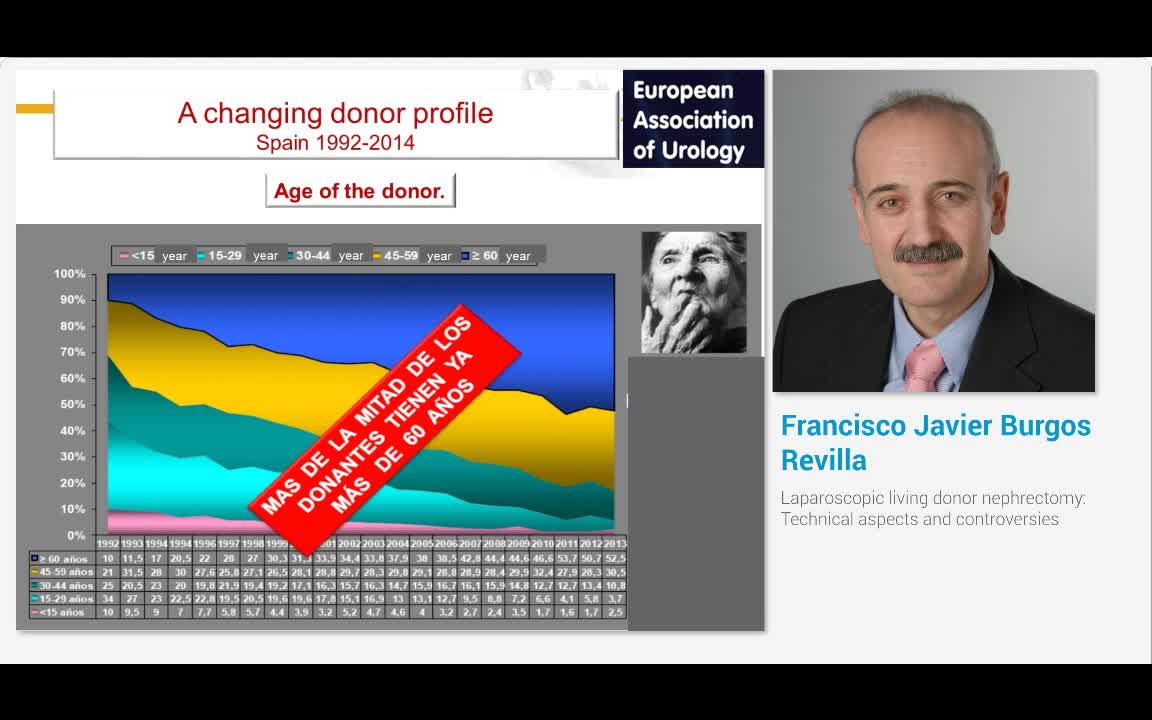 Laparoscopic living donor nephrectomy, Technical aspects ..-