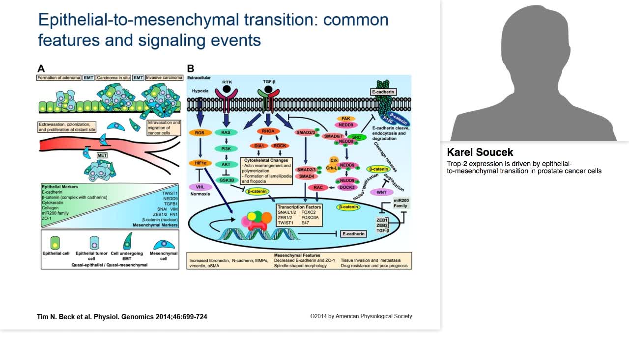 Trop-2 expression is driven by epithelial-to-mesenchymal -