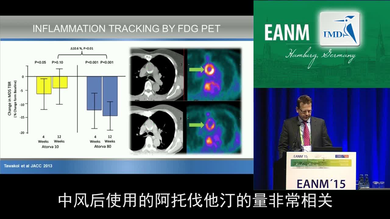 动脉粥样硬化：成像，从转化到临床（3）