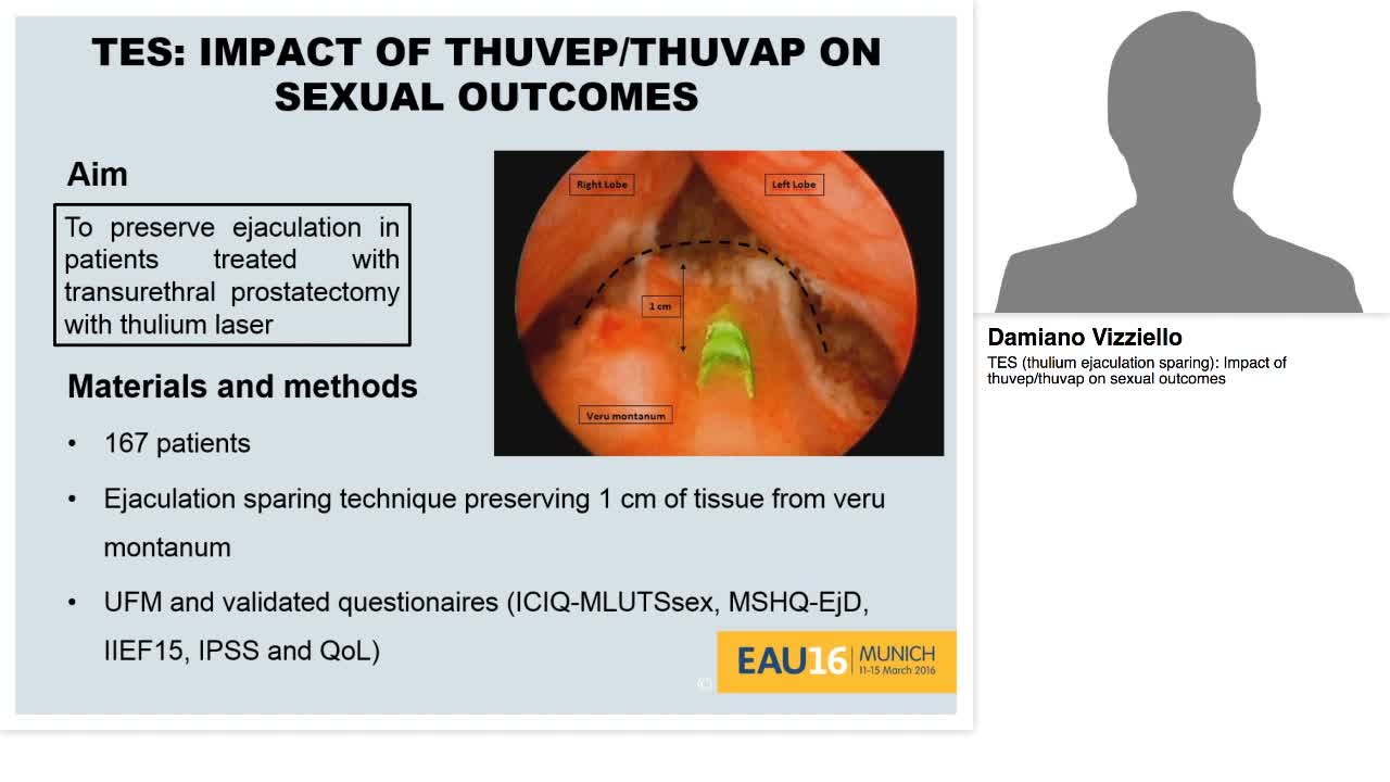 TES (thulium ejaculation sparing), Impact of thuvep-thuva-